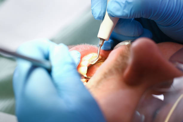 Best Emergency Dental Care for Abscessed Tooth in Harrisville, WV